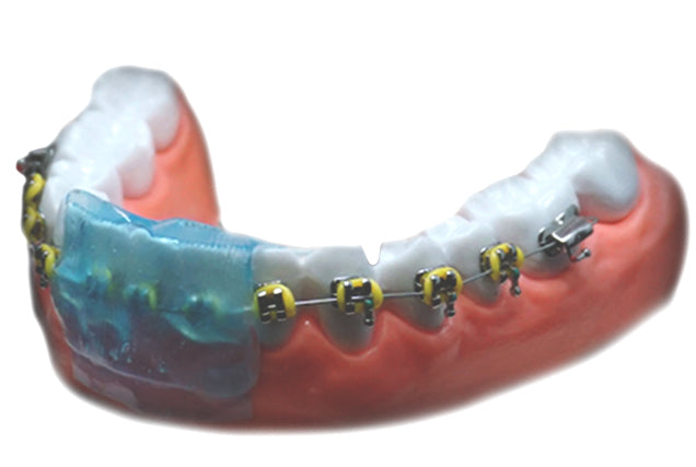 Protector Dental SILVERSTEIN Omniguard -2